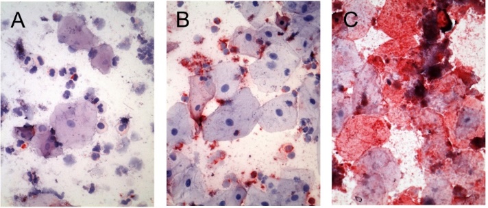 Saliva IHC assay in vitro drug safety test - three panels: A baseline biomarker expression before drug spike, B-C elevated biomarker level at 2 and 8 hours after drug spike in primary culture of normal human saliva