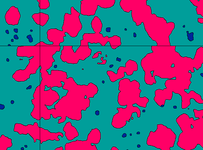 Visiopharm AI-powered segmentation showing accurate classification of epithelial cells (magenta) and non-epithelial cells (dark blue) in the same clinical saliva specimen
