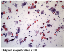 Cellular composition of human saliva — Hematoxylin and Eosin stain, original magnification x100